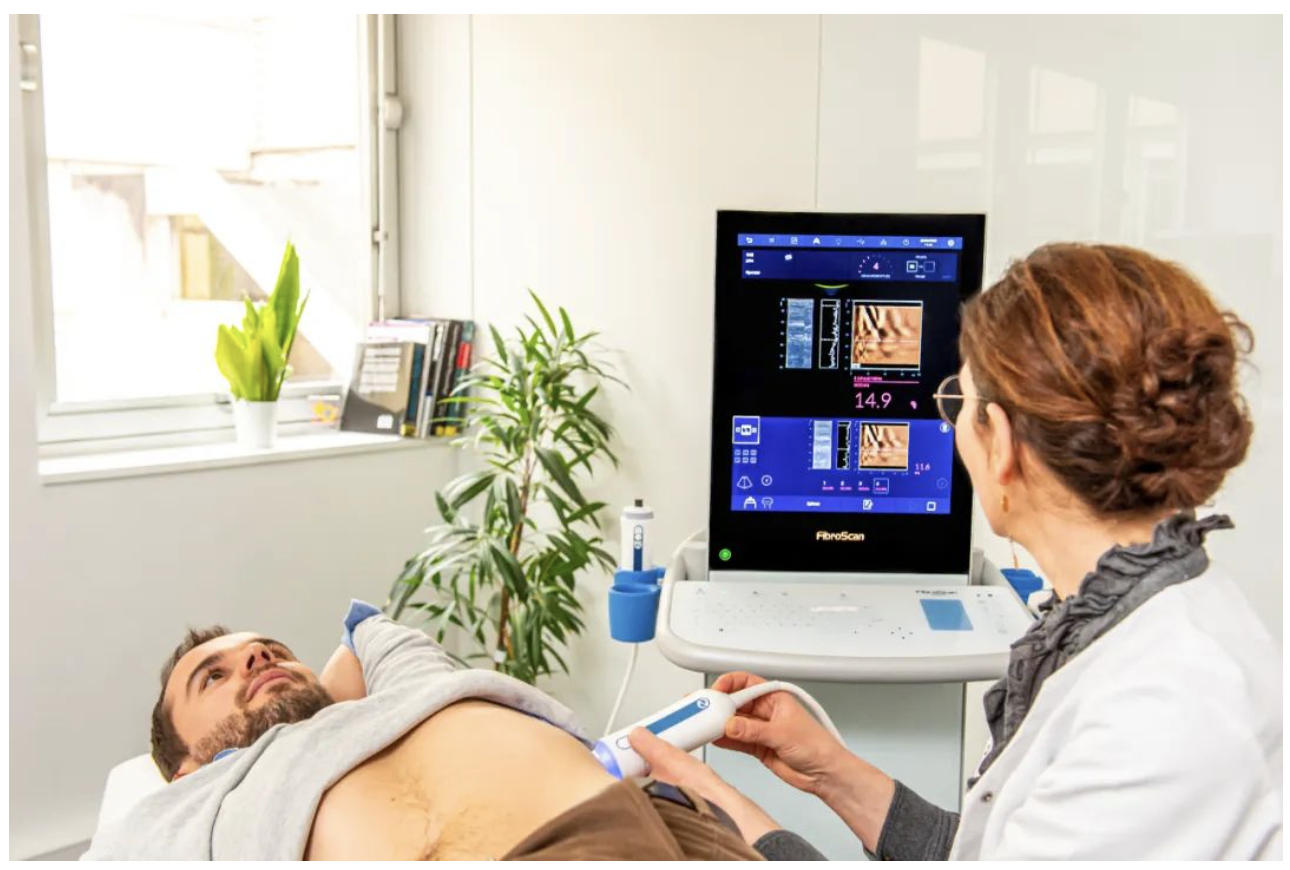 愛科森?學院專欄 | FibroScan?全球指南與共識推薦介紹（門靜脈高壓篇）