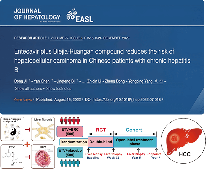 復方鱉甲軟肝片聯合抗病毒藥物治療，可顯著降低肝癌發生