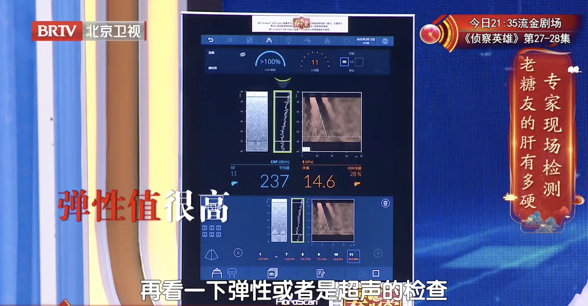 糖尿病肝損傷到底有多嚴重